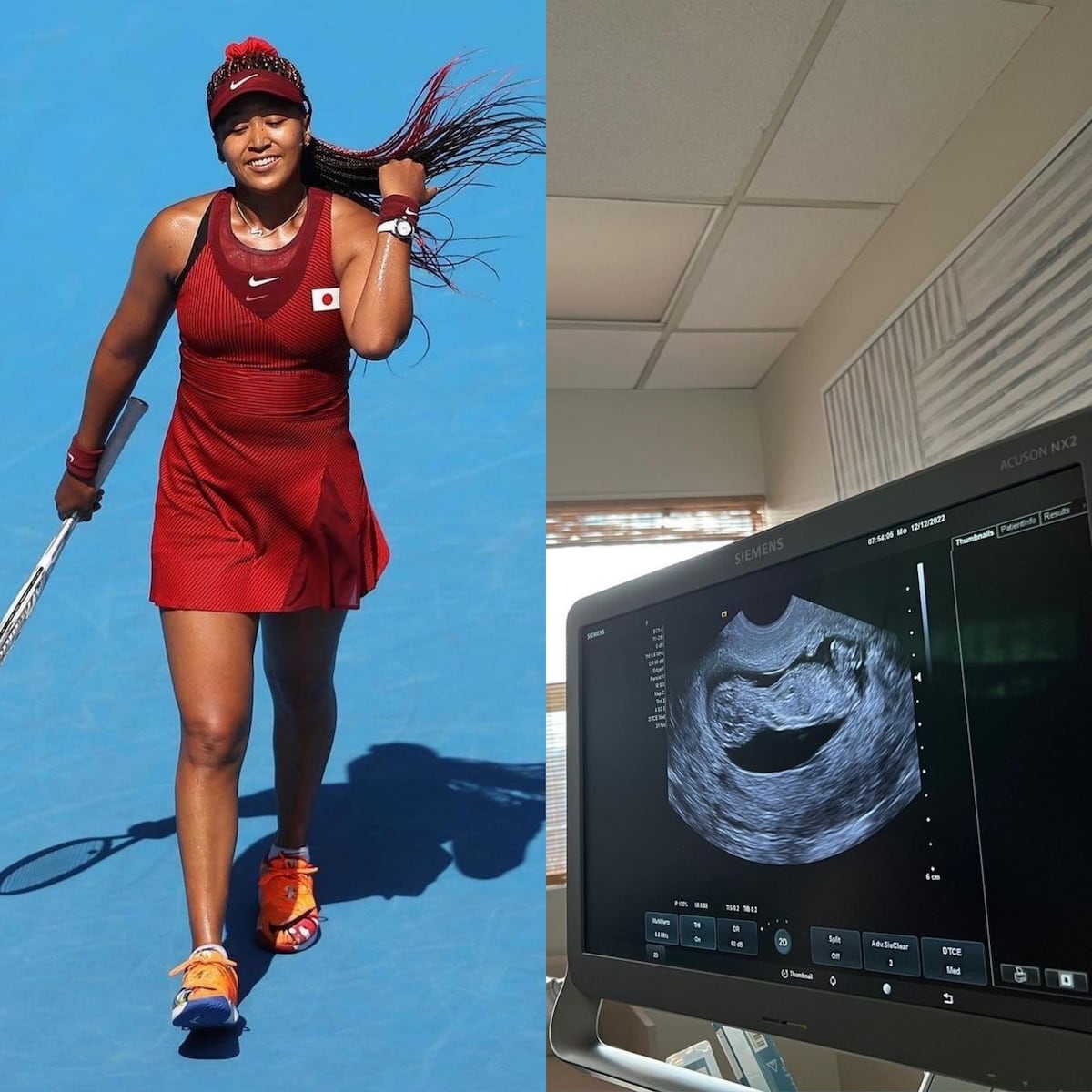 Famosas que se convertirán en mamá este año