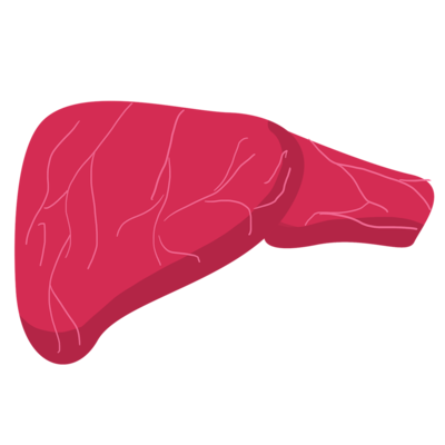 Hepatocarcinoma: la importancia del diagnóstico temprano y la vigilancia