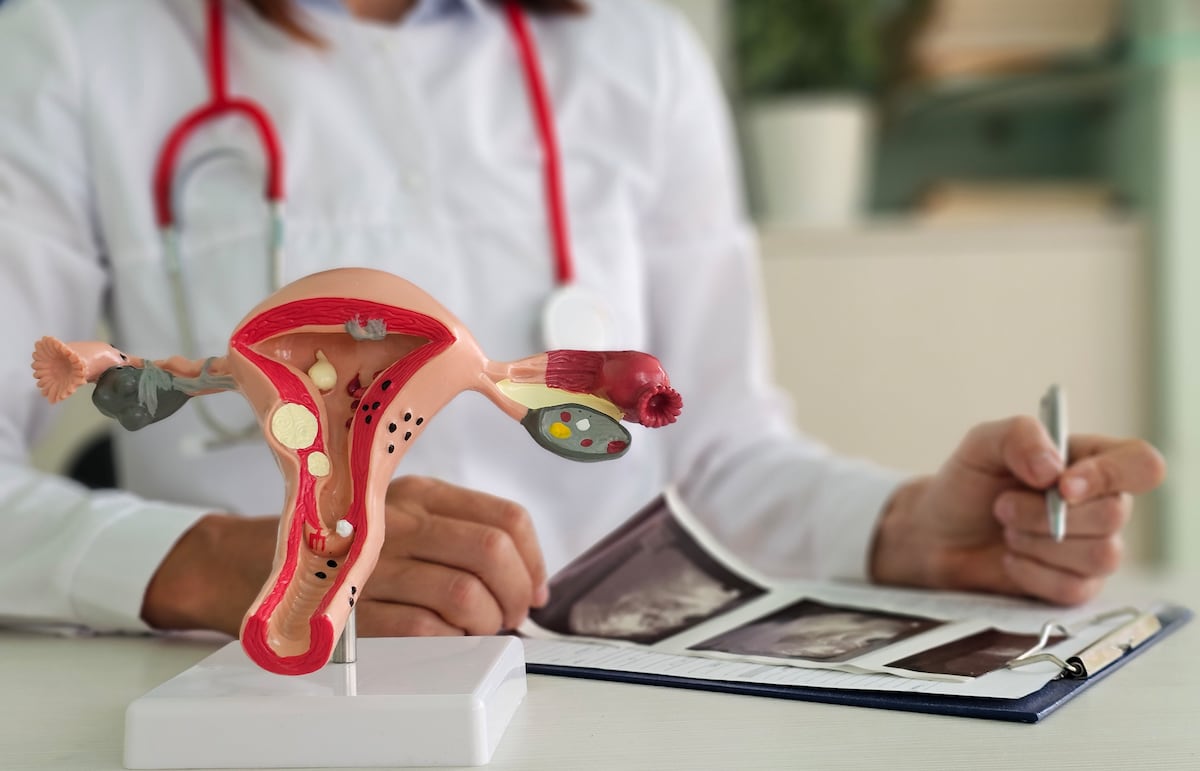 Tu guía para entender y detectar el cáncer ginecológico