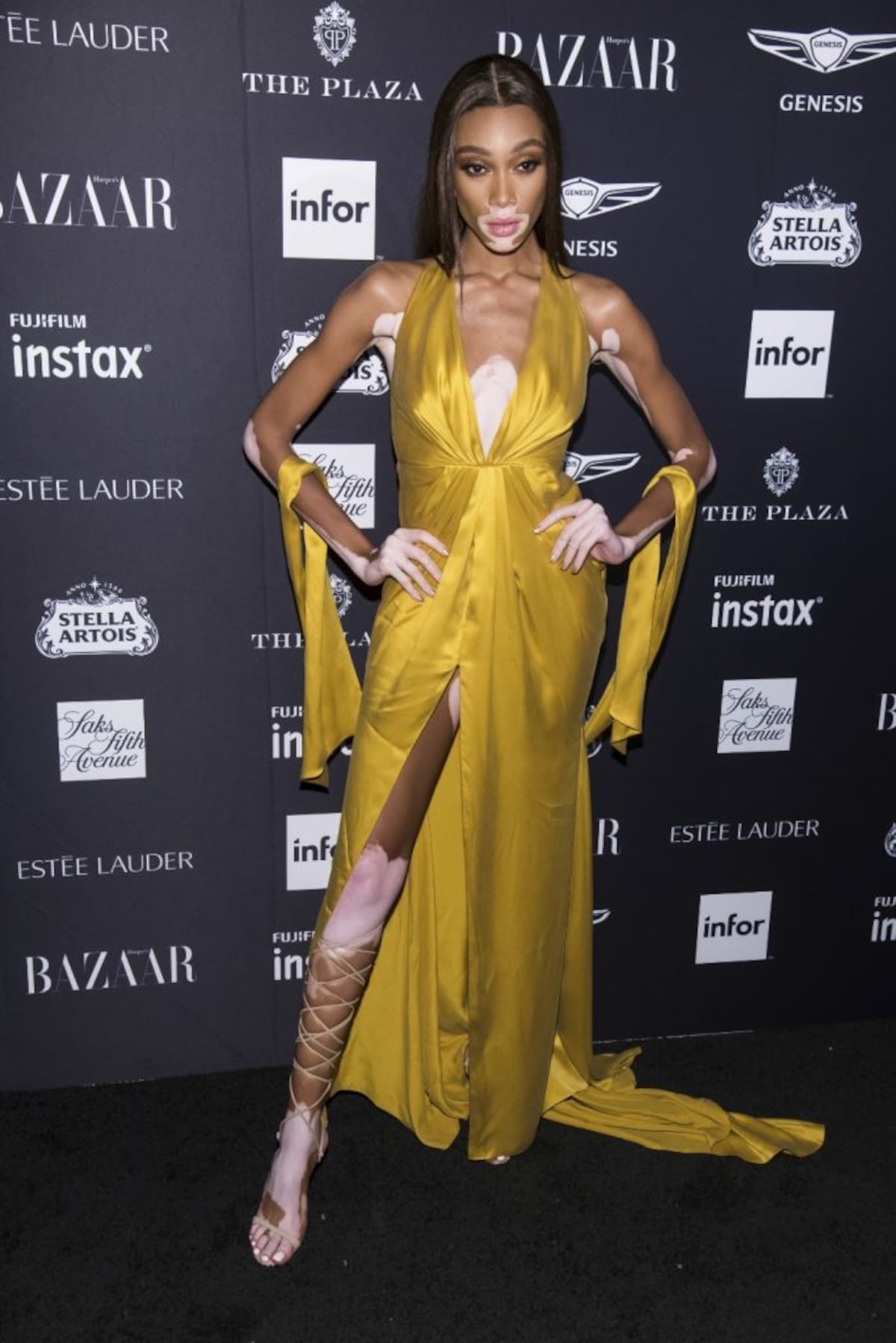 Winnie Harlow, la modelo con vitiligo que desfilará para Victoria’s Secret