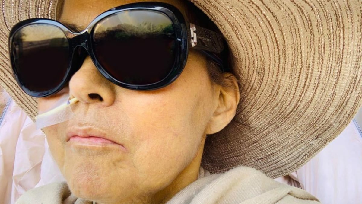 La mujer que se encogió casi 30 centímetros por una rara enfermedad