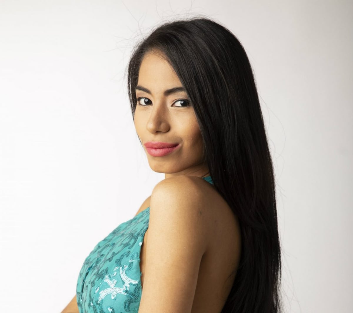 Paulett Rosales: ‘No lo llames problema, es vitiligo’