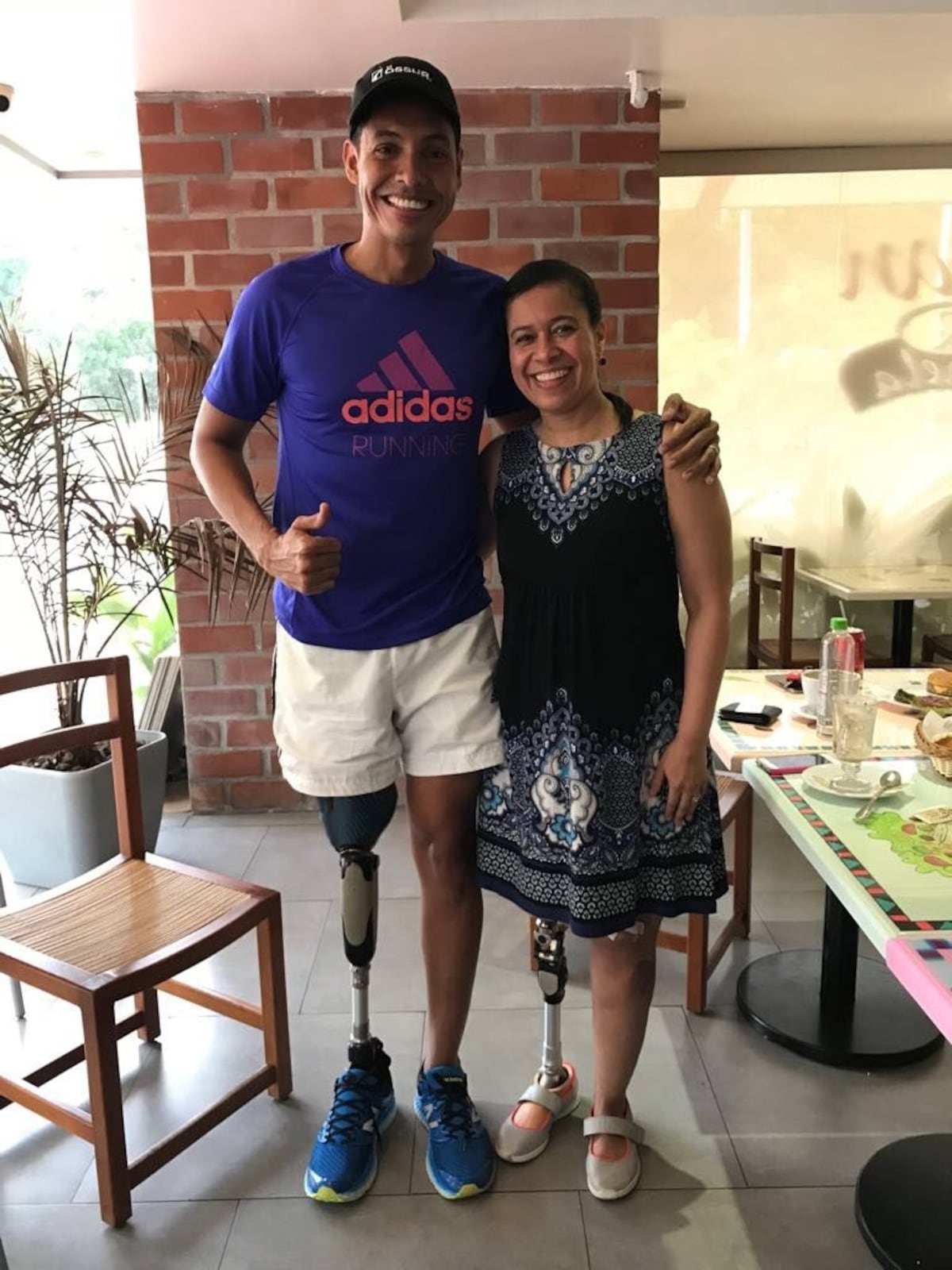 ‘Perder una pierna me hizo parar’