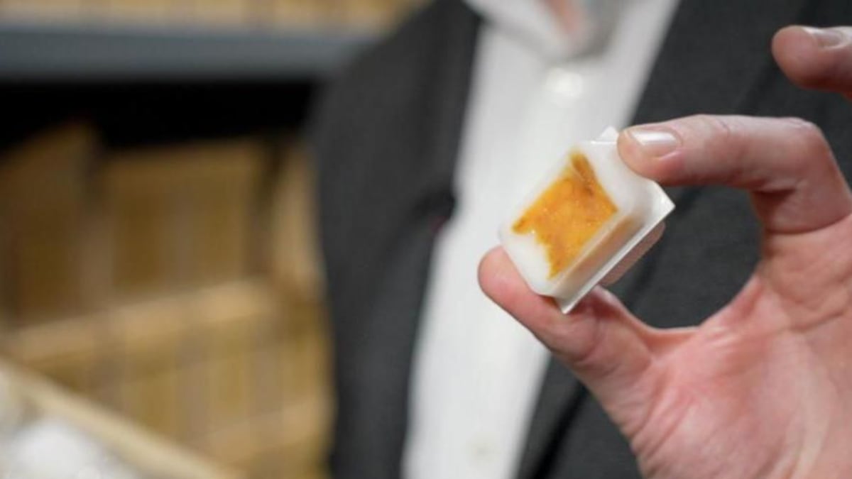 Los tumores de más de 100 años de antigüedad que podrían guardar el secreto de por qué están aumentando los casos de cáncer de intestino en jóvenes