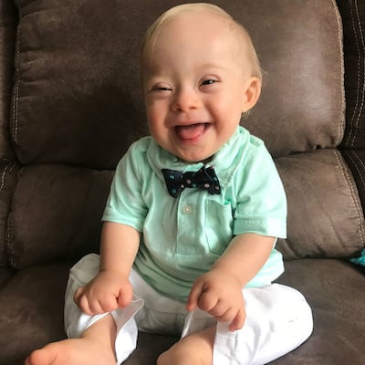 Lucas, el primer bebé Gerber con Síndrome de Down