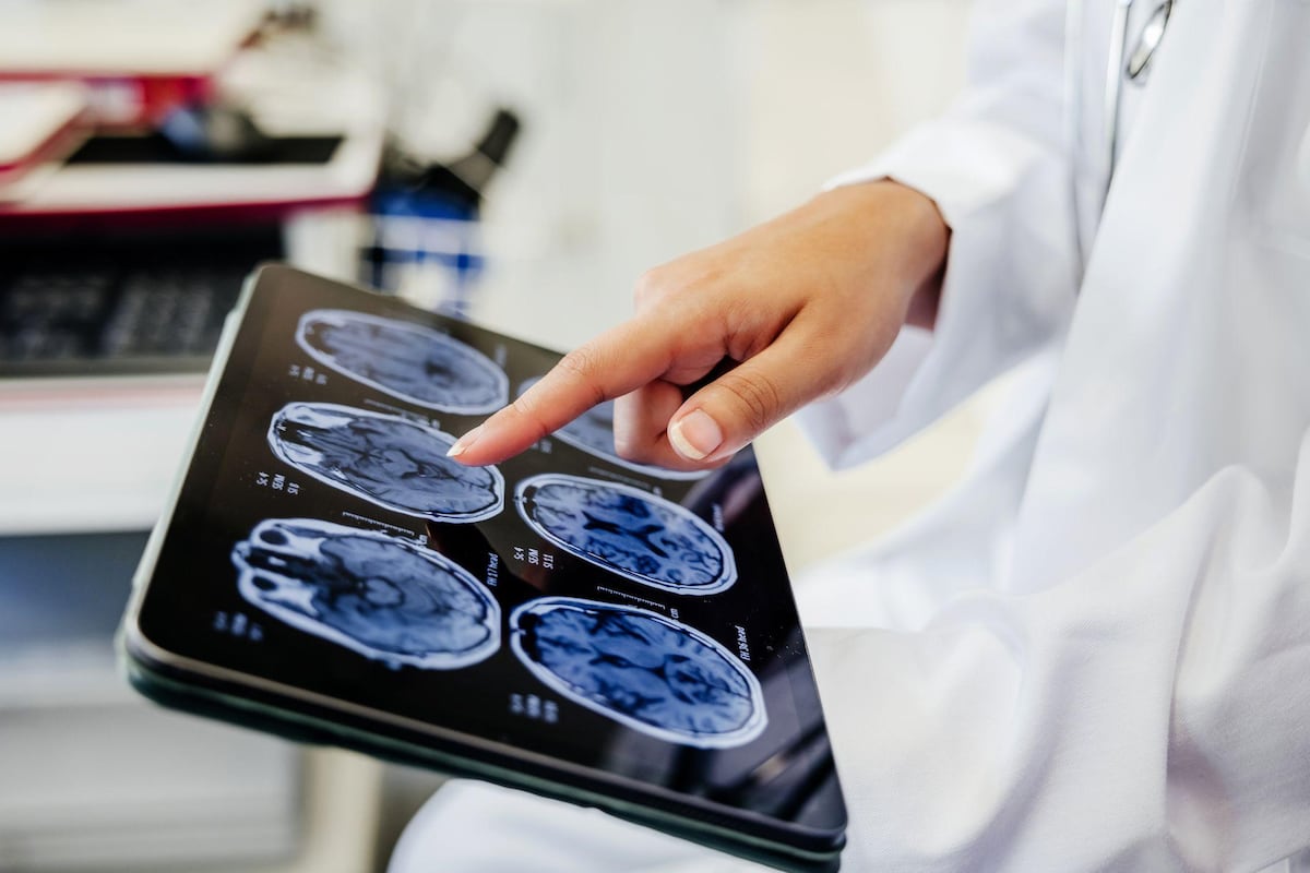 “Uno de los grandes misterios de la ciencia”: lo que la anestesia general revela sobre cómo funciona nuestro cerebro