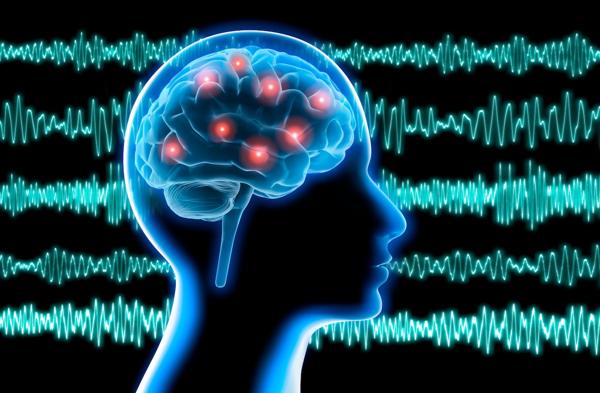 La estimulación cerebral profunda personalizada podría tratar la epilepsia resistente a los fármacos