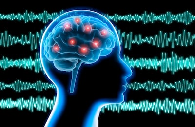 La estimulación cerebral profunda personalizada podría tratar la epilepsia resistente a los fármacos