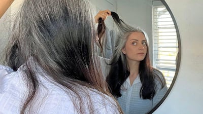 ¿Por qué me salieron canas a los 14 años? ¿Puedo revertirlo?