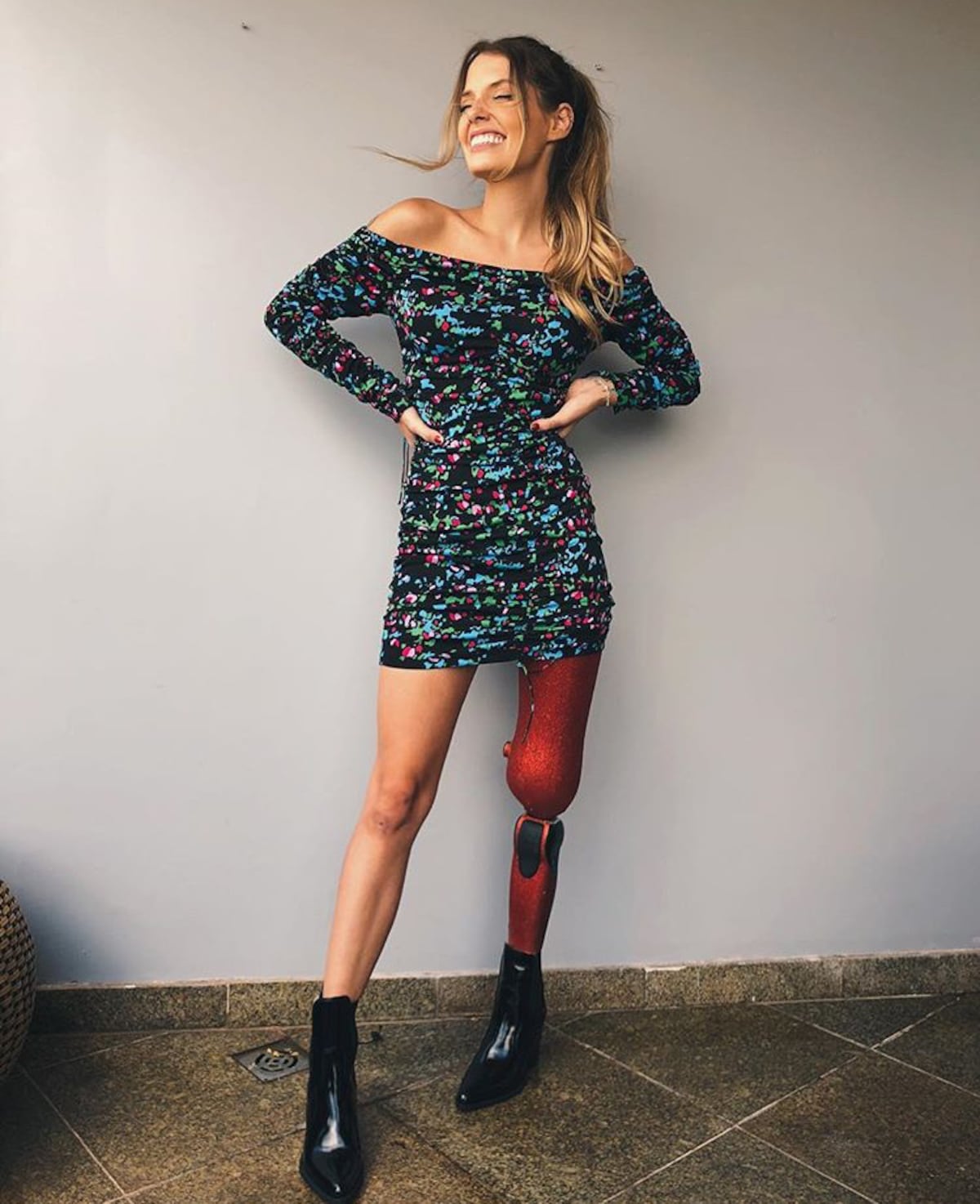 ‘Perder una pierna me hizo parar’