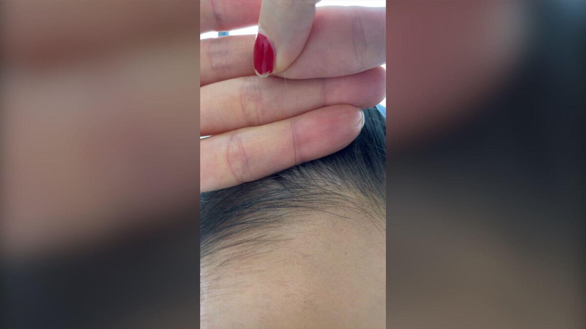 ¿Por qué me salieron canas a los 14 años? ¿Puedo revertirlo?