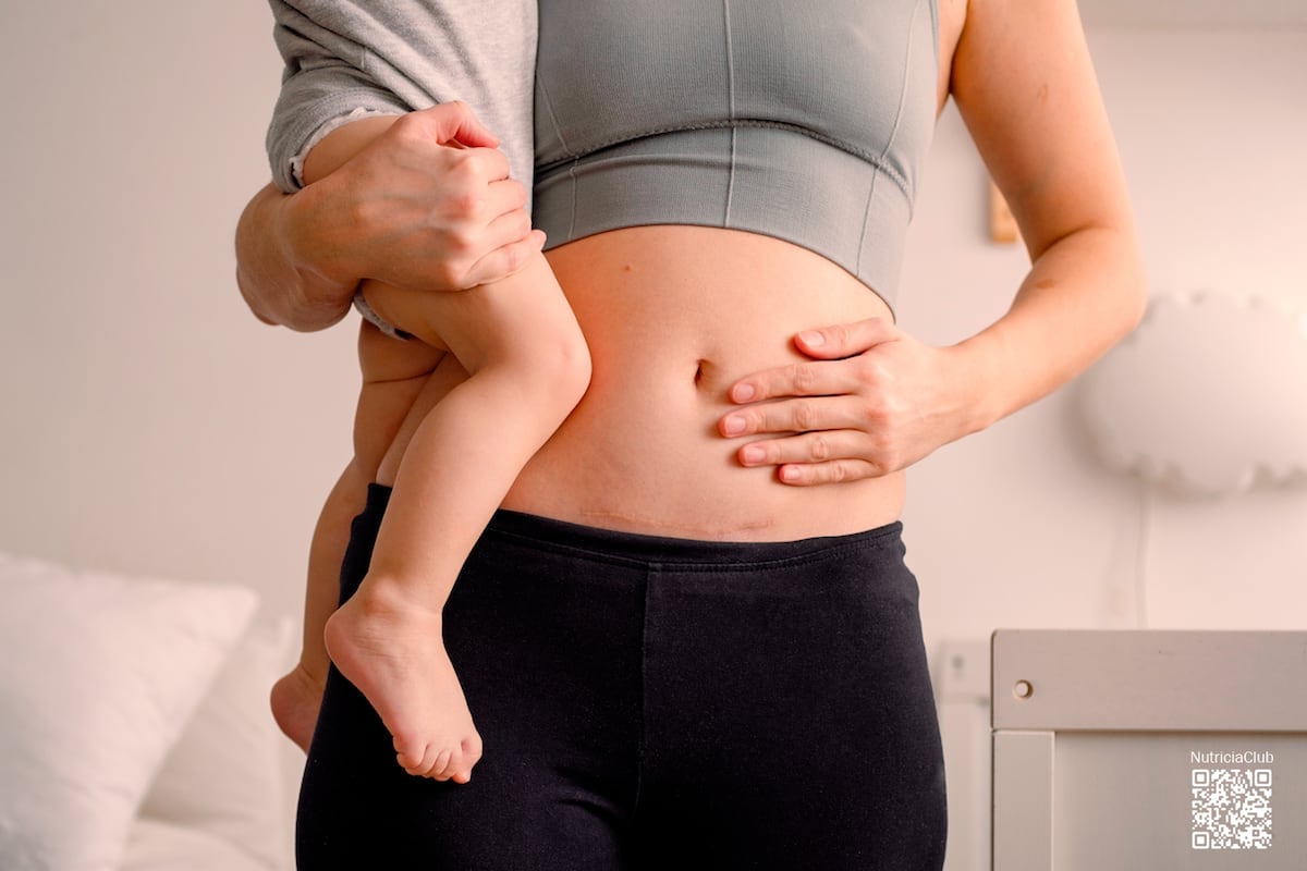 Cesárea: claves para una conexión saludable con tu bebé