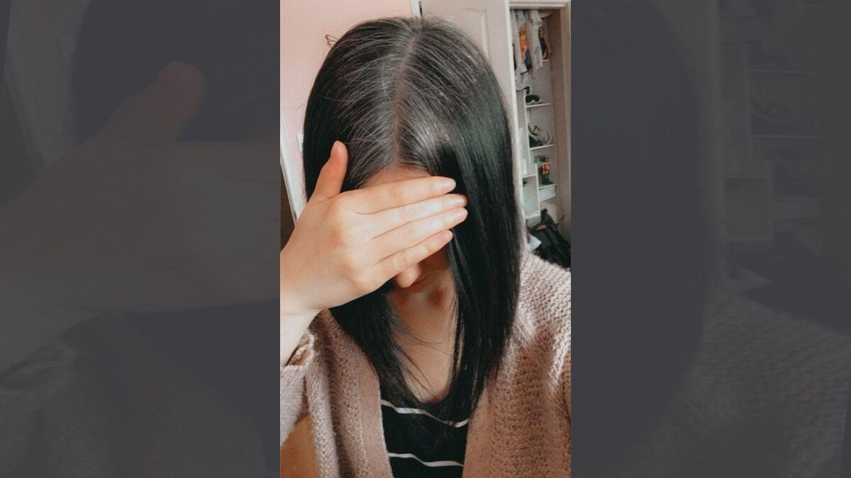 ¿Por qué me salieron canas a los 14 años? ¿Puedo revertirlo?