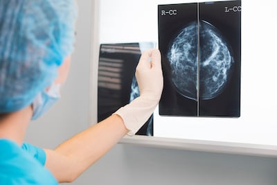 Cáncer de mama en Panamá: el diagnóstico aumenta y surgen más casos a partir de los 30 años 