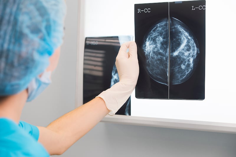 Cáncer de mama en Panamá: el diagnóstico aumenta y surgen más casos a partir de los 30 años 