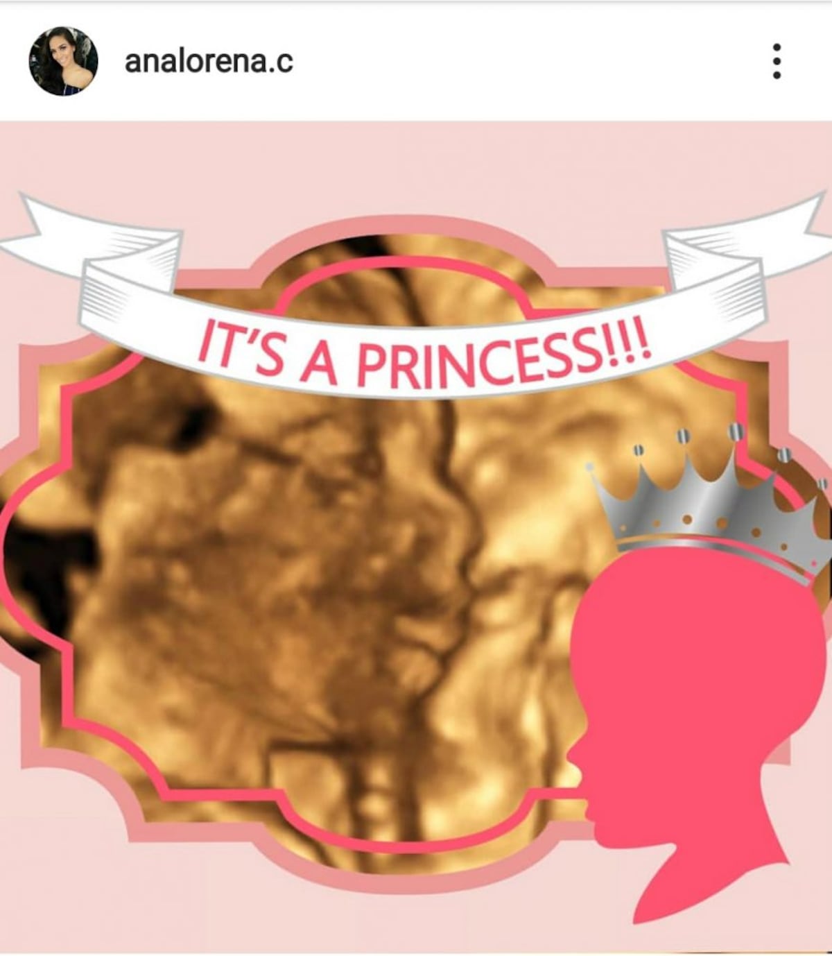 Ana Lorena Cortés y ‘Rommelito’ Gutiérrez revelan el sexo de su bebé