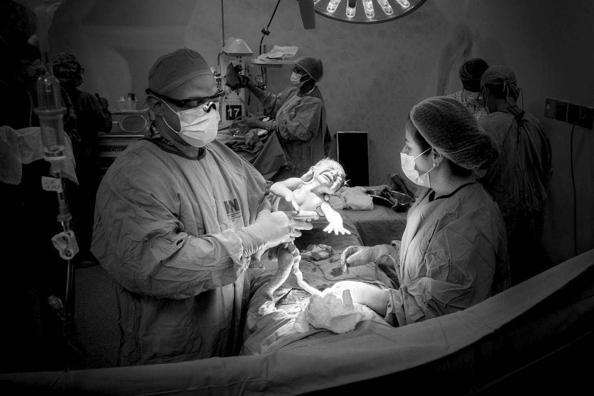 Susana Gow: La fotógrafa que captura partos y cesáreas