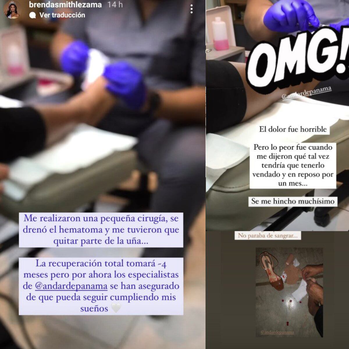 Señorita Panamá sufre accidente doméstico a una semana de viajar a Miss Universo