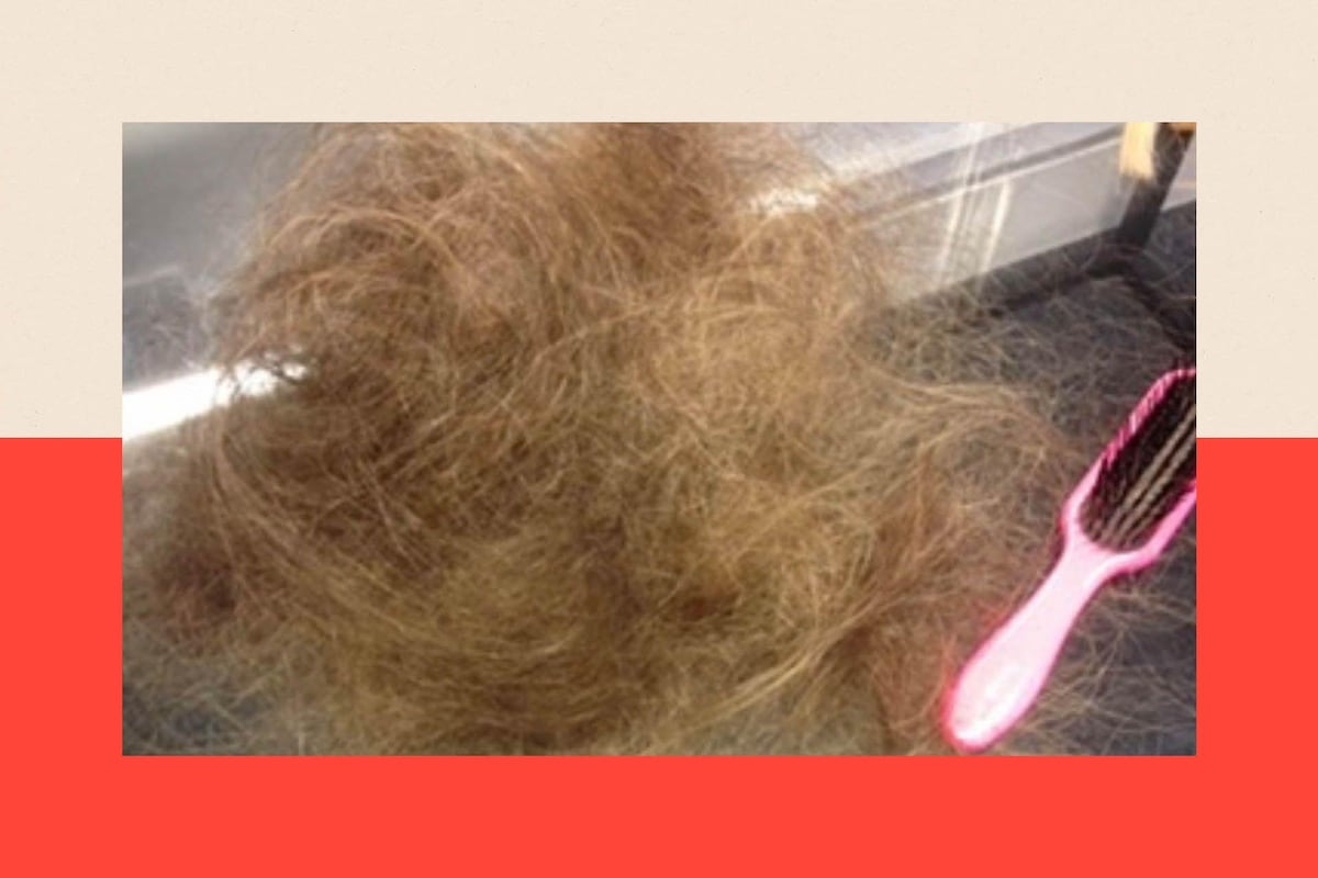 Lo que un avance contra la caída del cabello puede significar para mujeres como yo