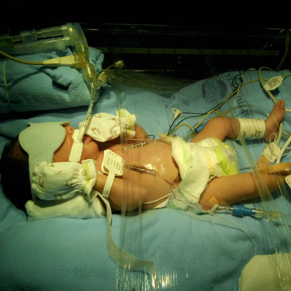 ‘Mi bebé nació a las 31 semanas’: relato de una mamá panameña