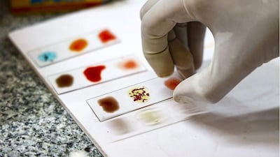 ‘Sangre dorada’: por qué los científicos están intentando cultivar la sangre más rara del mundo en un laboratorio