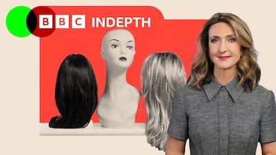 Lo que un avance contra la caída del cabello puede significar para mujeres como yo