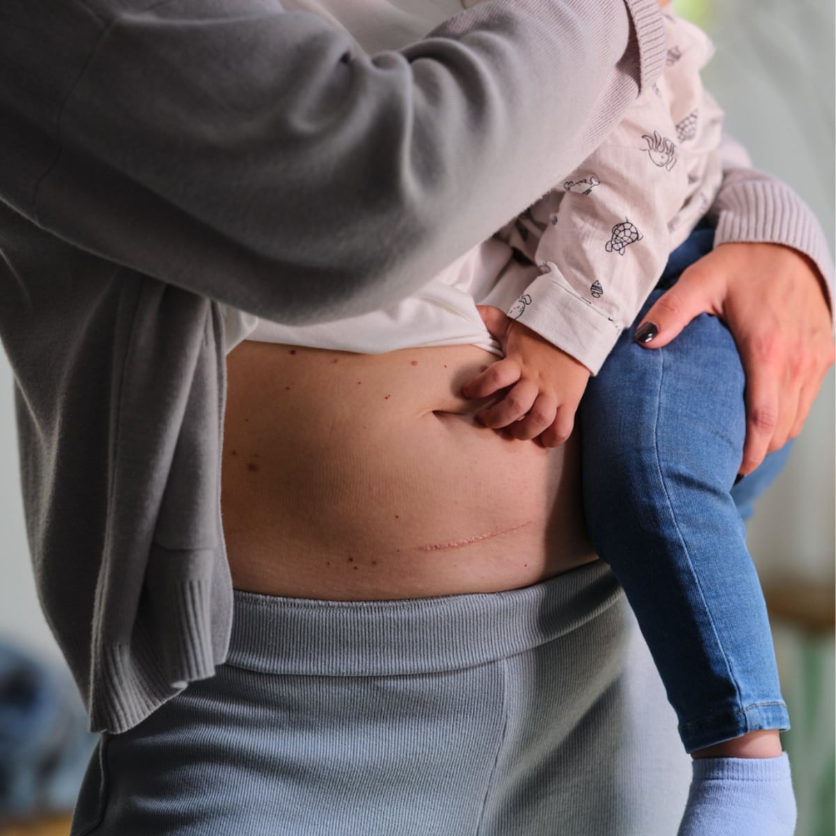 Lo que debes saber sobre la Bifidobacteria