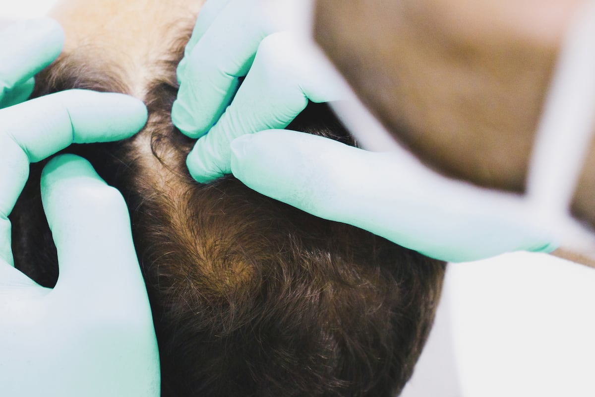 Tés e infusiones para sanar el cabello