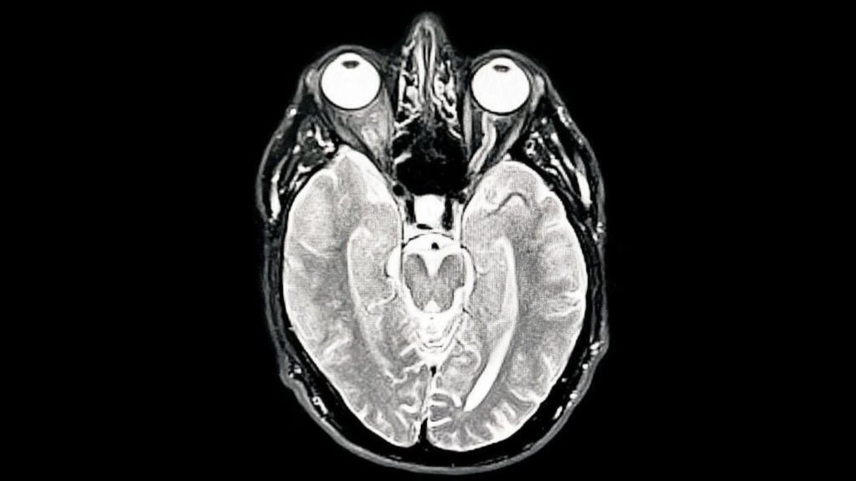 La adolescencia dura hasta los 30 años, según un nuevo estudio (y cuáles son las otras edades clave para el cerebro)
