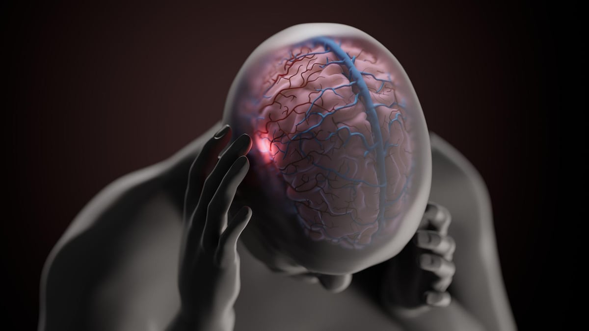 La carrera por desentrañar las causas de la migraña, uno de los trastornos menos comprendidos por la ciencia