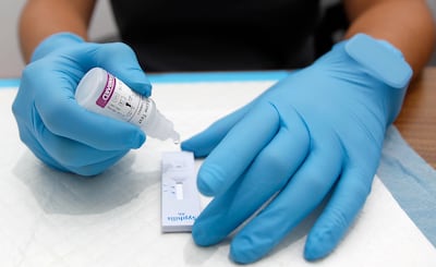 Panamá enfrenta grave desinformación: muchos aún confunden VIH y sida 