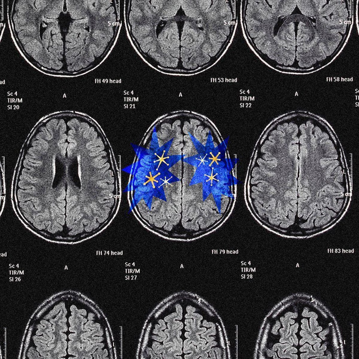 Qué es lo que realmente le hace la dopamina a nuestro cerebro
