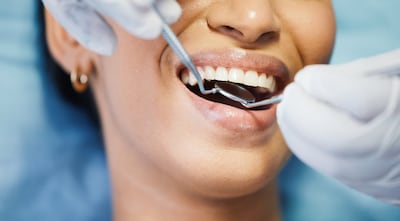 ¿Por qué es importante un chequeo dental antes de empezar la quimioterapia?