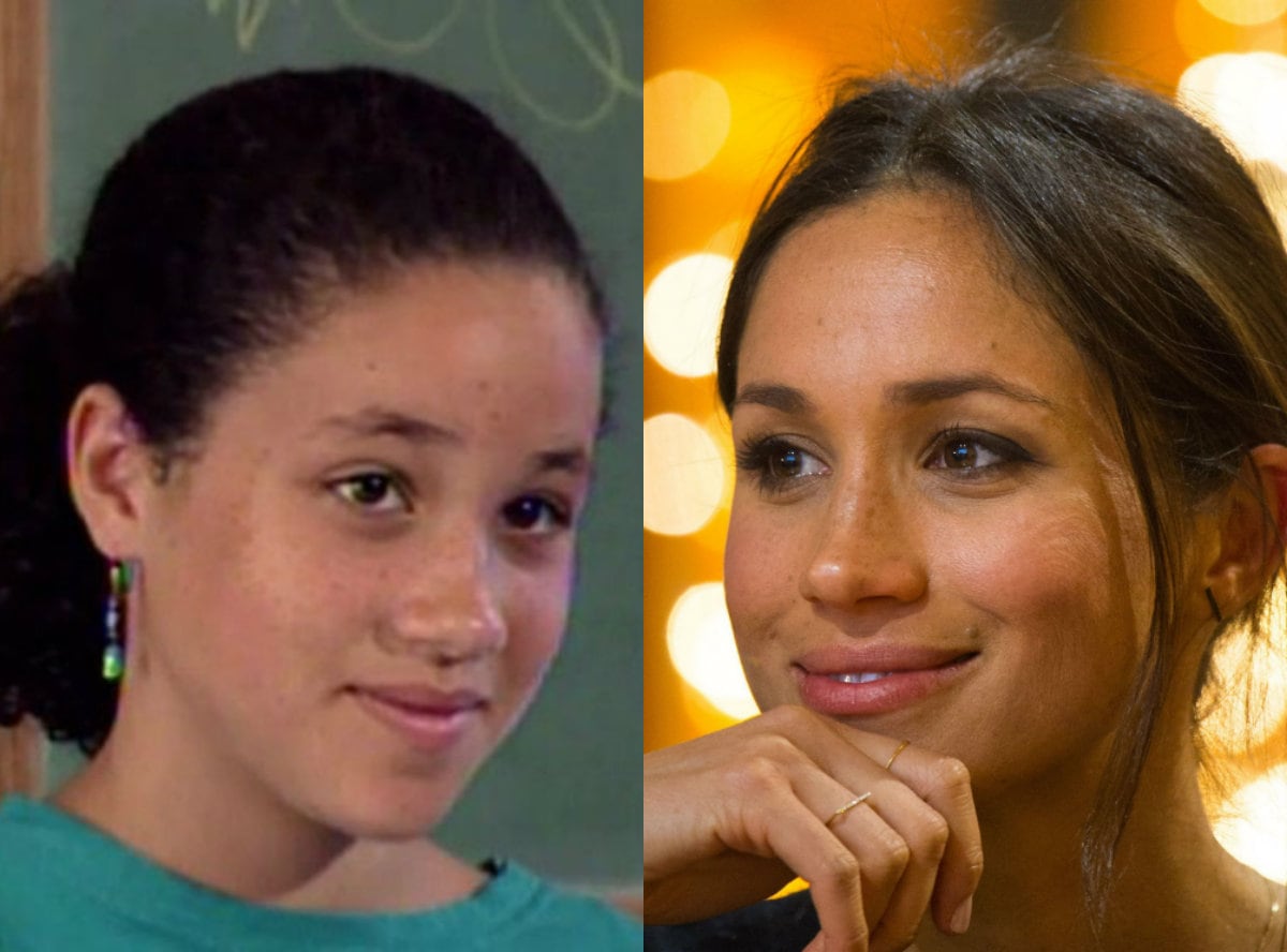 ¿Qué se hizo la duquesa Meghan en el rostro?