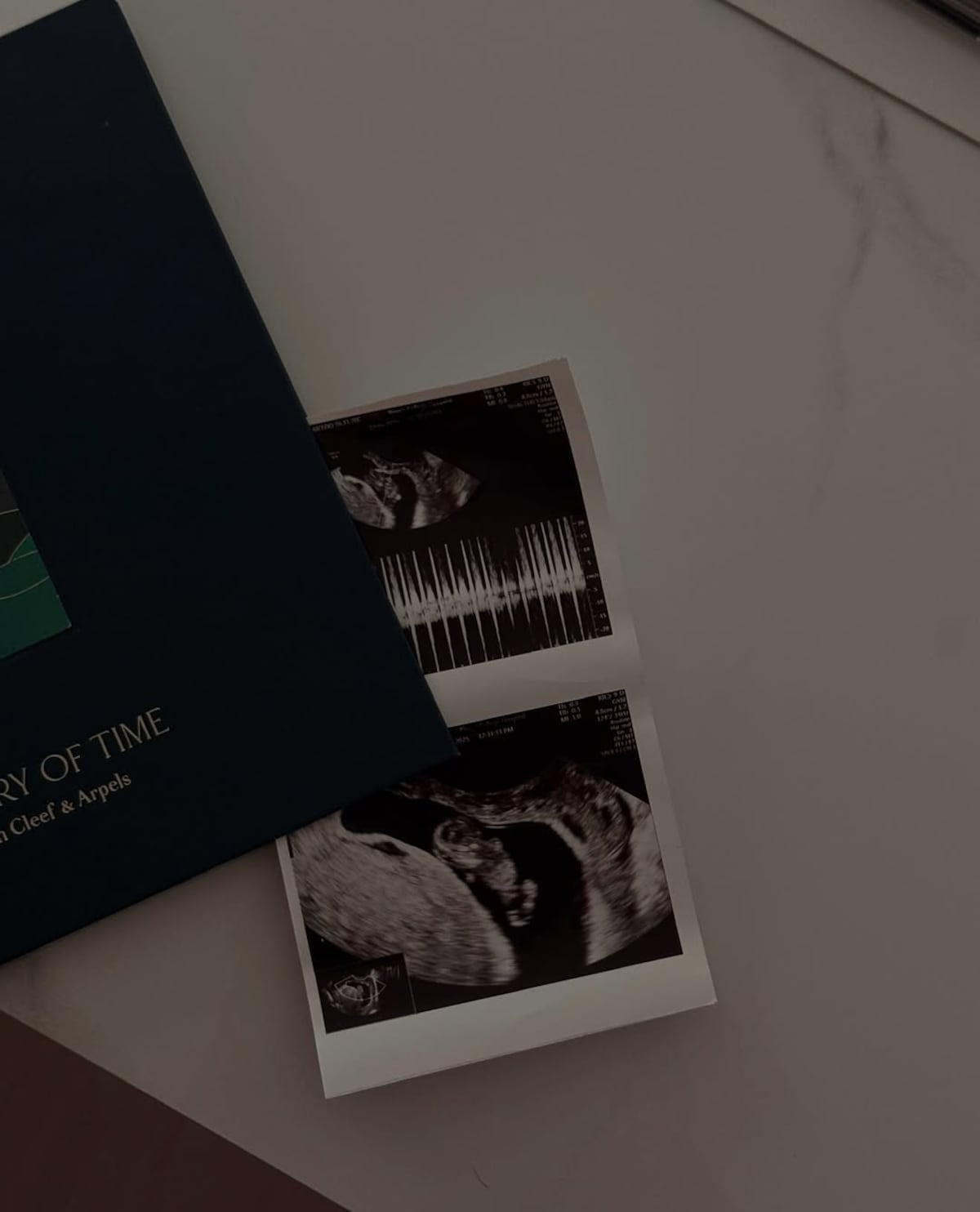 Miss Grand Panamá 2021, Katie Caicedo, revela el género de su bebé