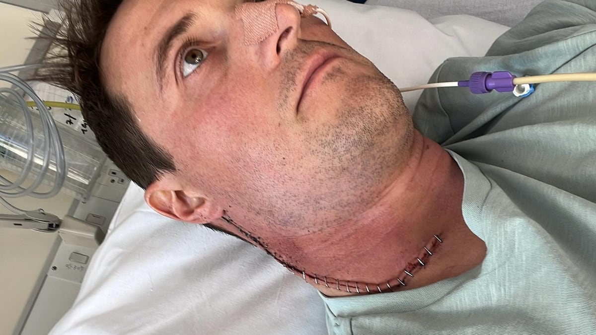 Casi pierdo la lengua por un cáncer y ahora alerto a otros hombres sobre el riesgo del virus del papiloma humano